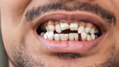 5 Causes Of Tooth Abnormalities