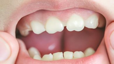 9 Most Common Dental Problems